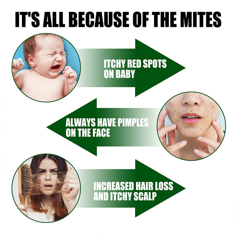 🔥LAST DAY SALE 50% OFF🔥Powerful Mite Remover Spray- Deep Clean, Protect Health!